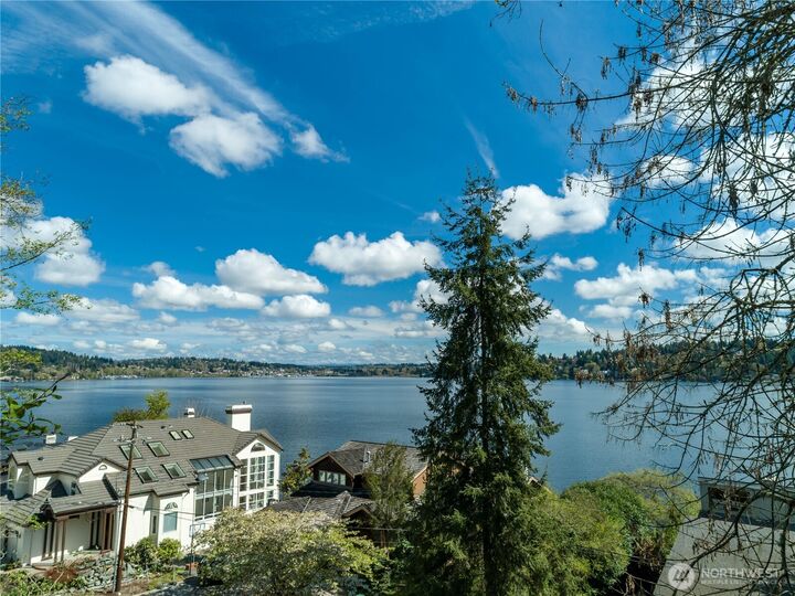 146 Xx  40th Avenue NE  Lake Forest Park WA 98155 photo