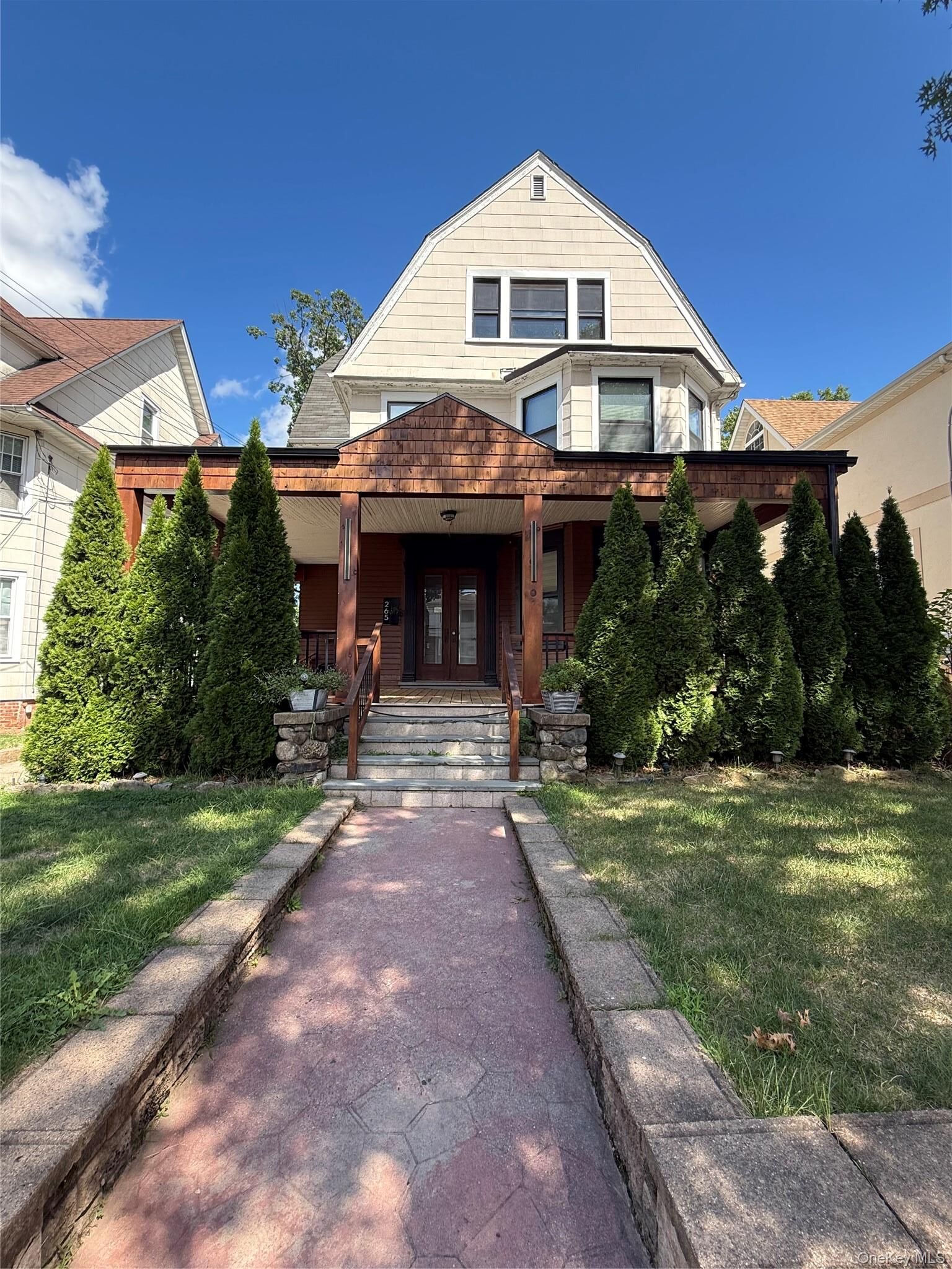 Property Photo:  265 Summit Avenue 3  NY 10552 